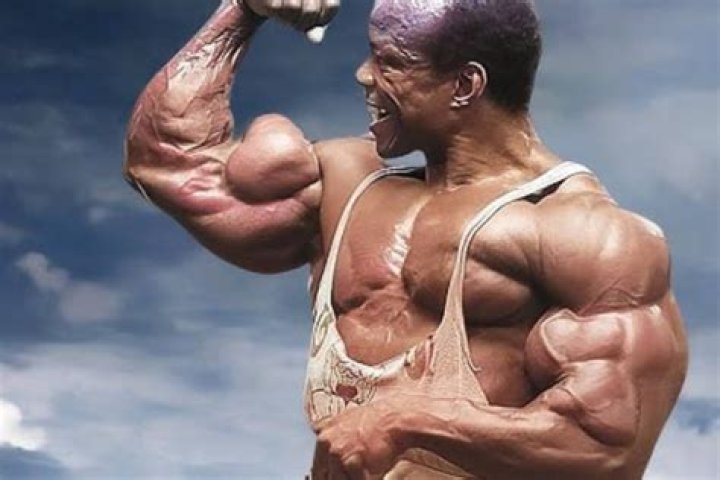 Albert Beckles