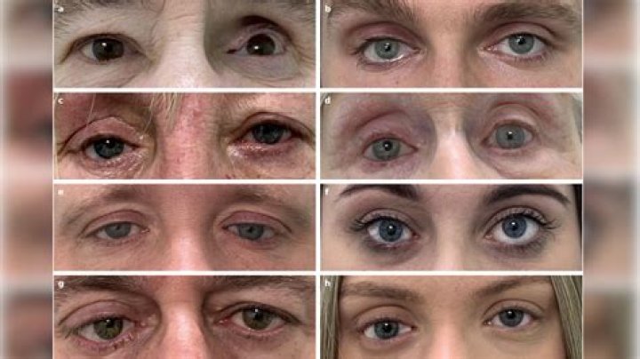 Is Ken Paxton Known to Have a Prosthetic Eye? - SarkariResult