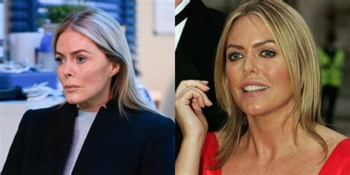 Patsy Kensit and Plastic Surgery: Examining the Facts and Separating Truth from Speculation Regarding Patsy Kensit's Cosmetic Procedures. - SarkariResult