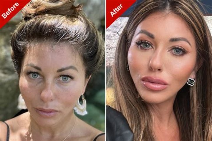 Priscilla Presley: All About Her Plastic Surgery, Before and After Pictures - SarkariResult