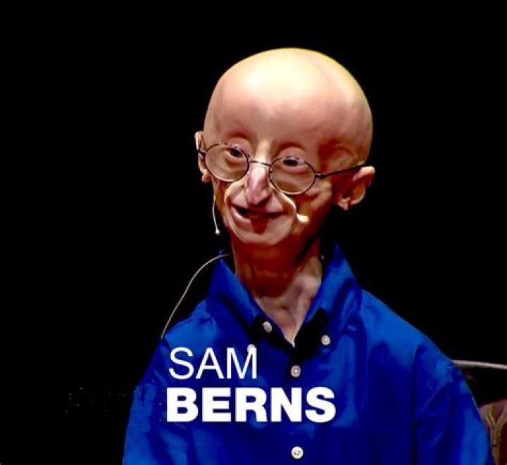 Sam Berns