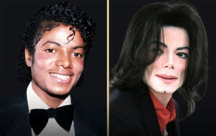 Who is Randy Jackson? Did He Get Plastic Surgery? - SarkariResult